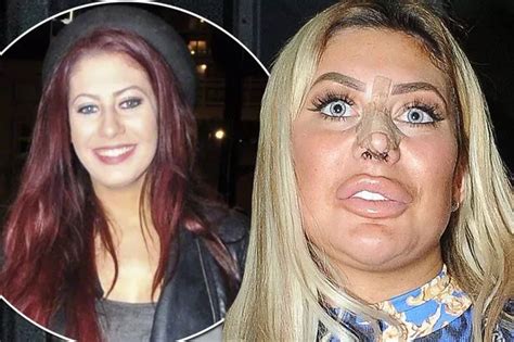 Chloe Ferry reveals she's 'DONE' with plastic surgery after .